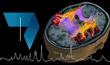 Fundamentals of Biomedical Imaging: Magnetic Resonance Imaging (MRI)