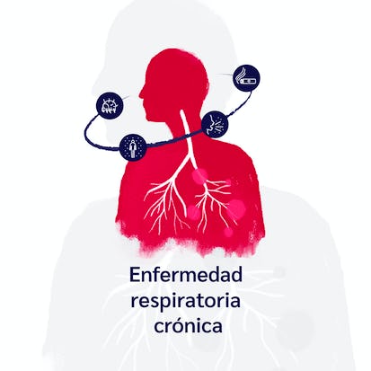 Enfermedad respiratoria crónica. Asma - EPOC
