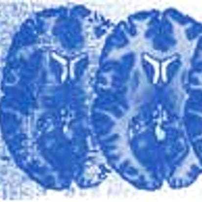 Neuroscience and Neuroimaging