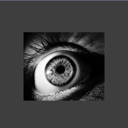 Diabetic Retinopathy Detection with Artificial Intelligence