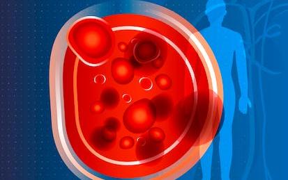 Anticoagulación