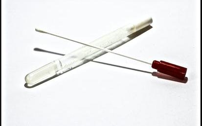 Point of Care Testing for Sexually Transmitted Infections