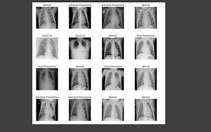 AI-Powered Chest Disease Detection and Classification